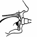 Trumpet Mouthpiece Diagram
